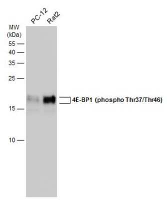 Western Blot: 4EBP1 [p Thr46, p Thr37] Antibody [NBP3-13170]